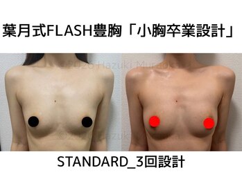 セブンシーズ 上野店(Seven Seas)/バストアップ/豊胸/東京都/上野