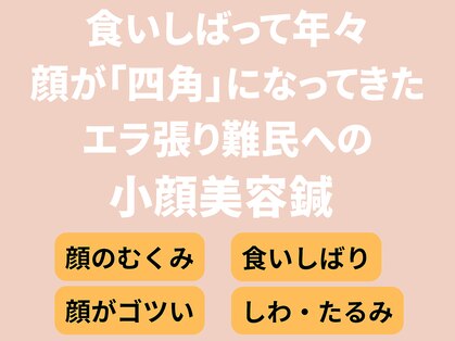 ねこのひげの写真
