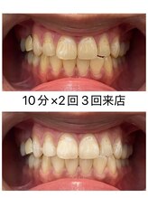 エム(M)/３回来店のお客様