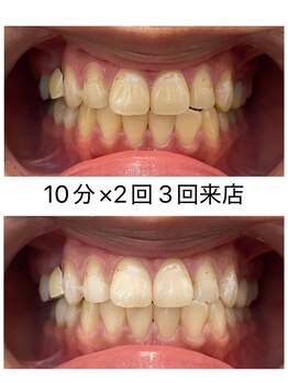 エム(M)/３回来店のお客様