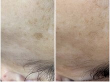 ニコ アンド キャンディー(Nico.&Candy)/