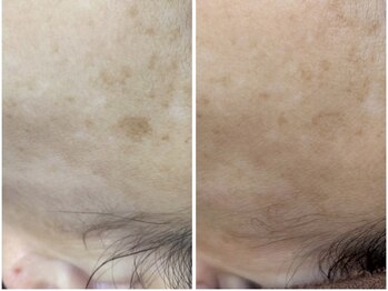 ニコ アンド キャンディー(Nico.&Candy)/