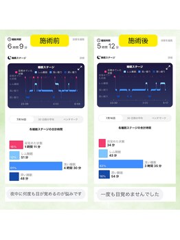 リルスペース(Rill Space)/ビフォーアフター(睡眠)