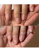 マイントゥ ネイル(mine too nail)/二枚爪や乾燥爪も！