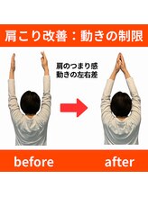 ララ鍼灸サロン(LaLa鍼灸サロン)/根本を突き止め悪化させない