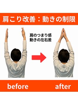 ララ鍼灸サロン(LaLa鍼灸サロン)/根本を突き止め悪化させない