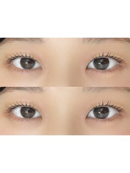 まつげのお悩み解決サロン