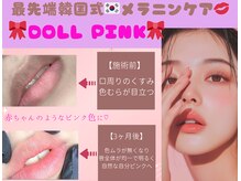 《最強モテリップ♪》◆ドールピンク◆1回の施術で3～5年持続◎