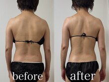 クレスト 山口店(Crest)/肩幅気になる方へ｜1回での変化