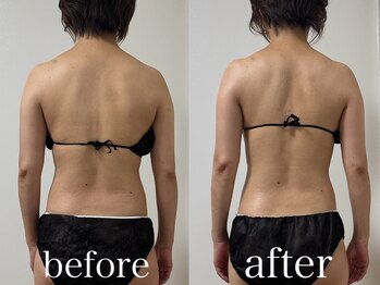 クレスト 山口店(Crest)/肩幅気になる方へ｜1回での変化