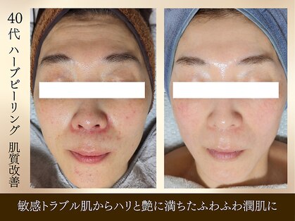 エボルブ 四条烏丸店(EVOLVE)の写真