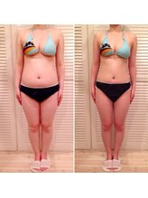 ビューティスペース バーディー(beauty space Birdy)/☆Before→After（前）☆