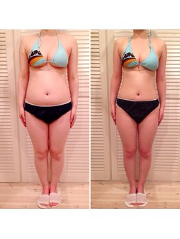 ビューティスペース バーディー(beauty space Birdy)/☆Before→After（前）☆