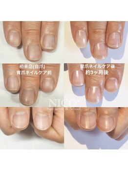 ニコプラス(NICO+)/爪育ネイルケア