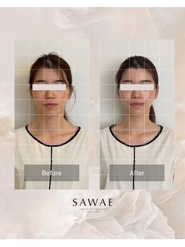 サワエギンザ(SAWAEGINZA)/before→after