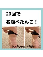 インタークロス(intercross)/本気痩せ！