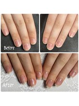 ルームイチマルイチネイルズ(Room101Nails.)/自爪育成・最強のネイルケア鳥取