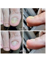 爪切り屋 足楽/