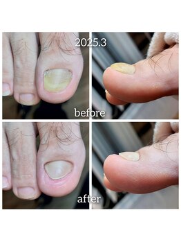 爪切り屋 足楽/