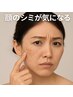 シミ卒●プラズマフェイシャル　　　ほほのみお試し１回　¥7,700→¥5,500