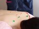 ときのはり鍼灸院(TOKINOHARI)の写真/【完全個室×女性鍼灸師オーナーが毎回施術】妊活/生理不調/ストレスによる頭痛まで鍼灸で！国家資格保持◎