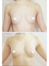 サロン アイミー(salon i me)/驚きのビフォーアフター