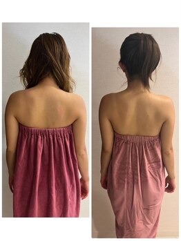 ロココ 豊田店(Rococo)/ビフォーアフター