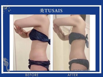 ビテュセ(美Tu sais)/【痩身・ダイエット】ボディケア