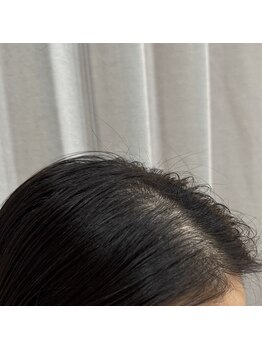 マイントゥー(mine too)/ケアを重ねていくと見違える☆