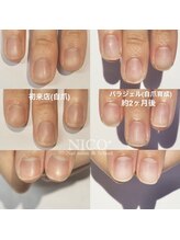 ニコプラス(NICO+)/自爪育成中