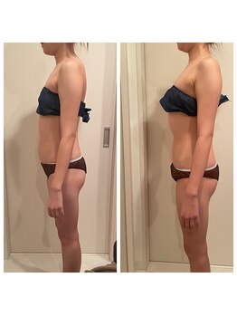 モモン シャルール/ハイパーナイフで姿勢も別人級♪