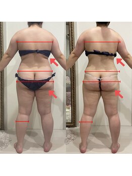 シュエットプラス(Chouette+)/体脂肪率45%越え