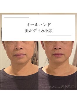 トータルエステティック ジョワイユ(JOYEUX)/身体もお顔も全身スッキリ