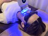 《セルフホワイトニング☆》綺麗な真っ白の歯で笑顔に自信を♪