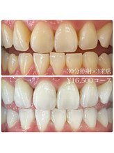 ホワイトニングルーム 横浜店(Whitening Room)/ホワイトニング/横浜