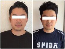 美容整体ウェリナ 中川八田院/小顔矯正/骨盤矯正/痩身整体