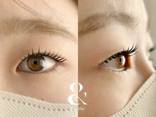 ムニ(muni)/&healthy【アンドヘルシー】