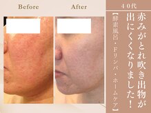 ケムズ インプルーブメントサロン(KMS IMPROVEMENT salon)/