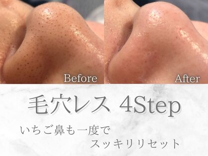ネオファースト(NeoFirst)の写真