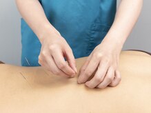 ファンクショナルマッサージ治療室 茅ヶ崎院/鍼灸でリラックス