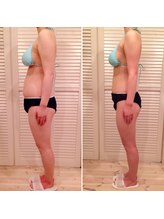 ビューティスペース バーディー(beauty space Birdy)/☆Before→After（横）☆