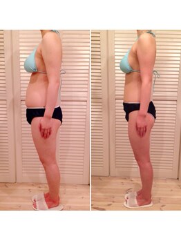 ビューティスペース バーディー(beauty space Birdy)/☆Before→After（横）☆