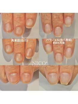 ニコプラス(NICO+)/自爪育成中