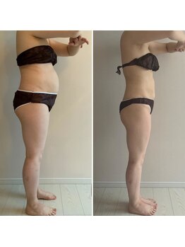 カーム整骨院/ダイエット整体ビフォーアフター