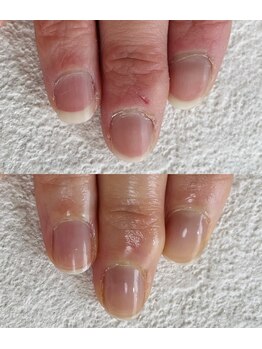 シーネイル(C Nail)/白い部分がピンクに変わる