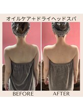 アルパカ(ALPAKA)/体のゆがみにお悩みの方