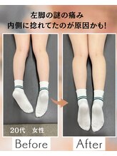 ウェルビーイング整体院 水戸赤塚店(wellbeing整体院)/Before After