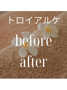 リラクゼーションサロン ラキ(laki)/トロイアルケbefore after