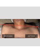 ツカ(TSUKA)/施術側は肩の緊張がほぐれました