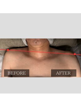 ツカ(TSUKA)/施術側は肩の緊張がほぐれました